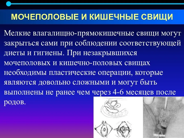 Мелкие влагалищно-прямокишечные свищи могут закрыться сами при соблюдении соответствующей диеты и гигиены.