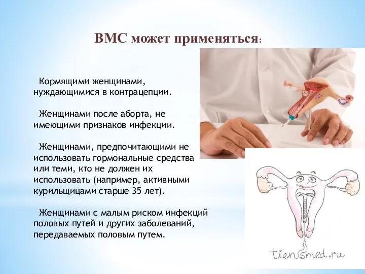 ВМС может применяться: Кормящими женщинами, нуждающимися в контрацепции. Женщинами после аборта, не