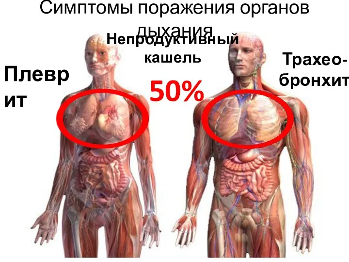 Симптомы поражения органов дыхания Трахео-бронхит Плеврит Непродуктивный кашель 50%