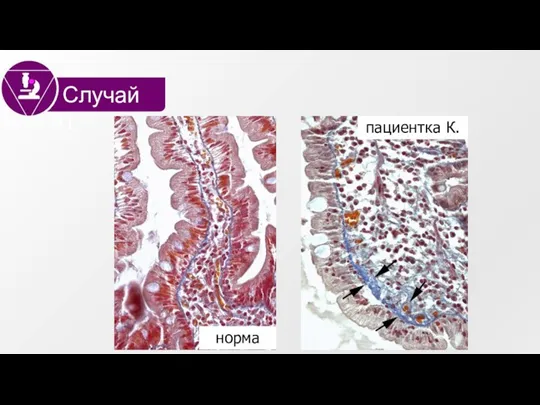 Случай #1 норма пациентка К.