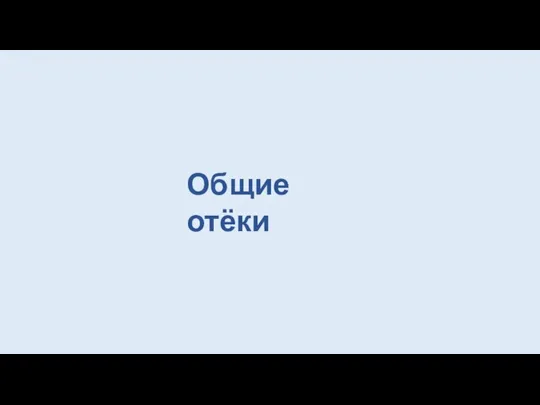 Общие отёки