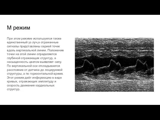 М режим При этом режиме используется также единственный уз луч,а отраженные сигналы