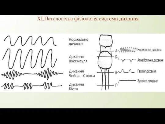 XI.Патологічна фізіологія системи дихання