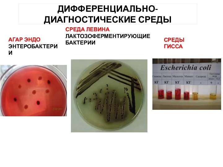 ДИФФЕРЕНЦИАЛЬНО-ДИАГНОСТИЧЕСКИЕ СРЕДЫ АГАР ЭНДО ЭНТЕРОБАКТЕРИИ СРЕДА ЛЕВИНА ЛАКТОЗОФЕРМЕНТИРУЮЩИЕ БАКТЕРИИ СРЕДЫ ГИССА