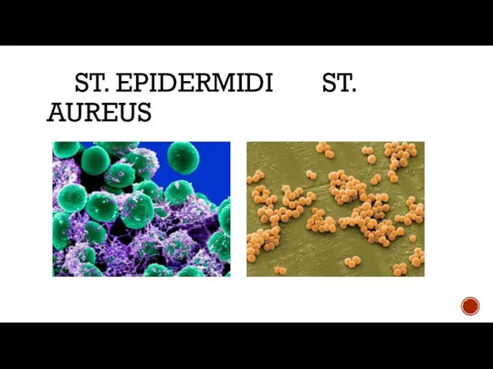ST. EPIDERMIDI ST. AUREUS