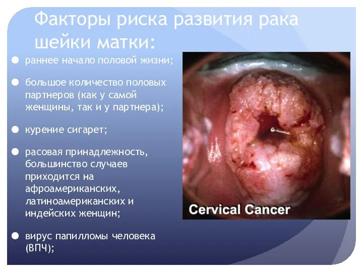 Факторы риска развития рака шейки матки: раннее начало половой жизни; большое количество