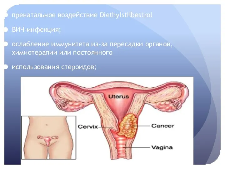 пренатальное воздействие Diethylstilbestrol ВИЧ-инфекция; ослабление иммунитета из-за пересадки органов, химиотерапии или постоянного использования стероидов;