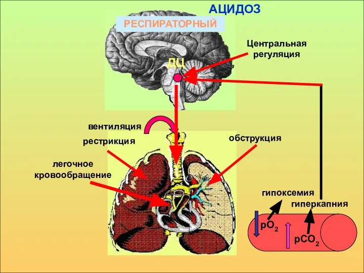 рО2 рСО2 гипоксемия гиперкапния Центральная регуляция ДЦ РЕСПИРАТОРНЫЙ вентиляция рестрикция обструкция легочное кровообращение АЦИДОЗ
