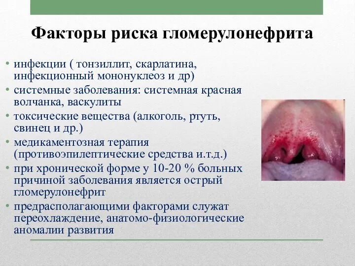 Факторы риска гломерулонефрита инфекции ( тонзиллит, скарлатина, инфекционный мононуклеоз и др) системные