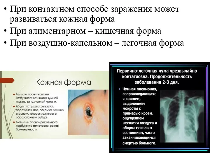 При контактном способе заражения может развиваться кожная форма При алиментарном – кишечная