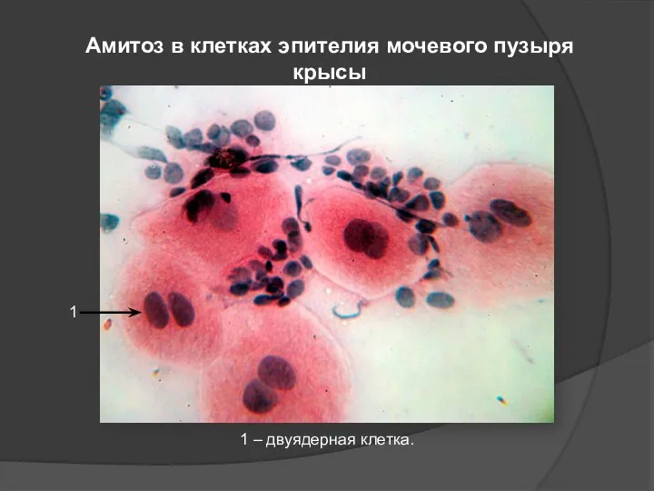 Амитоз в клетках эпителия мочевого пузыря крысы 1 1 – двуядерная клетка.