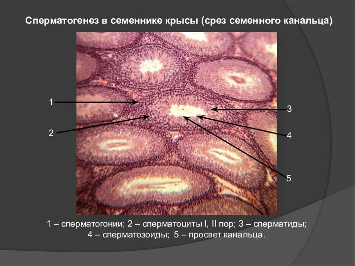 Сперматогенез в семеннике крысы (срез семенного канальца) 1 – сперматогонии; 2 –