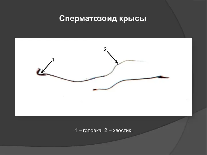 Сперматозоид крысы 1 2 1 – головка; 2 – хвостик.