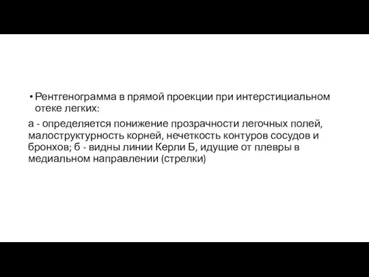 Рентгенограмма в прямой проекции при интерстициальном отеке легких: а - определяется понижение