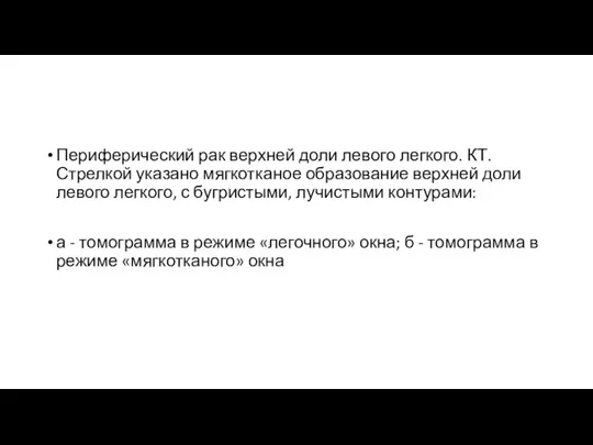 Периферический рак верхней доли левого легкого. КТ. Стрелкой указано мягкотканое образование верхней