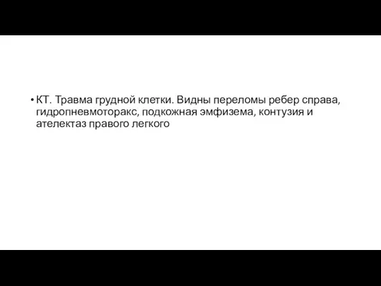 КТ. Травма грудной клетки. Видны переломы ребер справа, гидропневмоторакс, подкожная эмфизема, контузия и ателектаз правого легкого