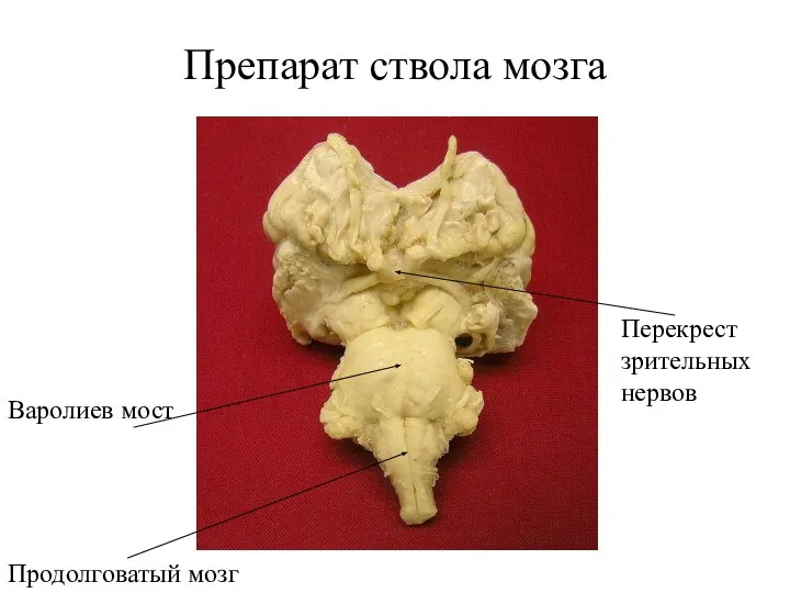 Препарат ствола мозга Продолговатый мозг Варолиев мост Перекрест зрительных нервов