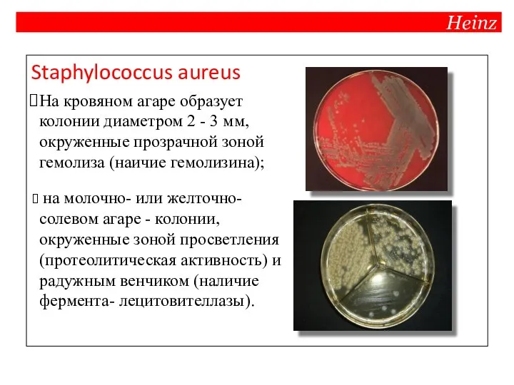 Heinz Staphylococcus aureus На кровяном агаре образует колонии диаметром 2 - 3