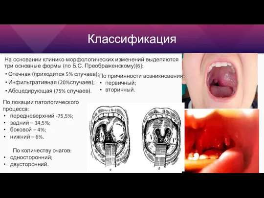 Классификация На основании клинико-морфологических изменений выделяются три основные формы (по Б.С. Преображенскому)[6]: