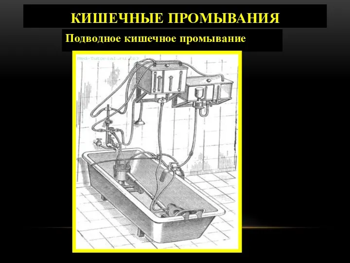 КИШЕЧНЫЕ ПРОМЫВАНИЯ Подводное кишечное промывание