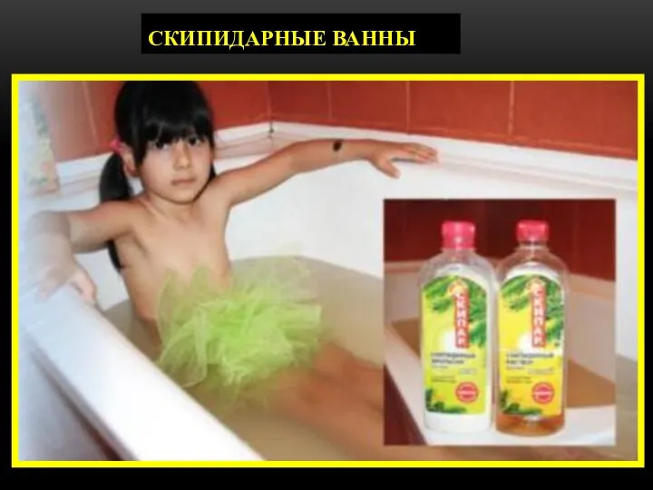 СКИПИДАРНЫЕ ВАННЫ