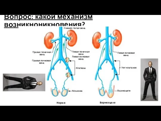 Вопрос: какой механизм возникноникновения?