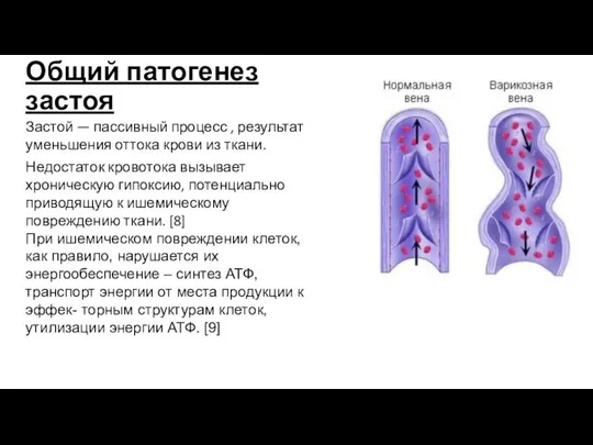 Общий патогенез застоя Застой — пассивный процесс , результат уменьшения оттока крови