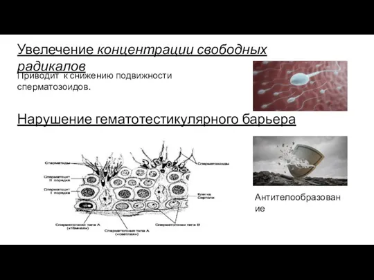 Увелечение концентрации свободных радикалов Приводит к снижению подвижности сперматозоидов. Нарушение гематотестикулярного барьера Антителообразование