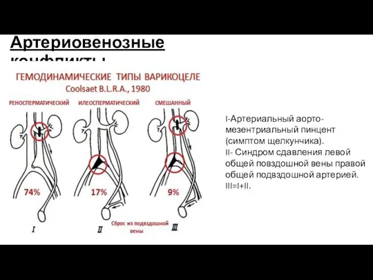 Артериовенозные конфликты I-Артериальный аорто-мезентриальный пинцент (симптом щелкунчика). II- Синдром сдавления левой общей