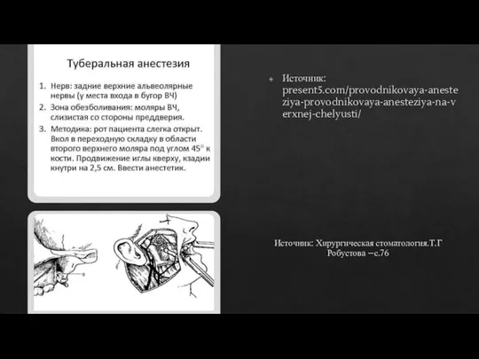 Источник: Хирургическая стоматология.Т.Г Робустова –с.76 Источник: present5.com/provodnikovaya-anesteziya-provodnikovaya-anesteziya-na-verxnej-chelyusti/