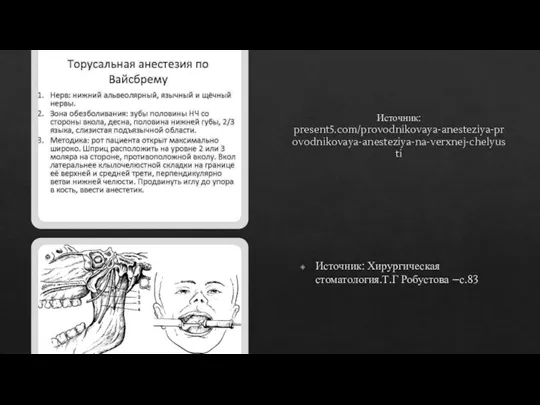 Источник: present5.com/provodnikovaya-anesteziya-provodnikovaya-anesteziya-na-verxnej-chelyusti Источник: Хирургическая стоматология.Т.Г Робустова –с.83