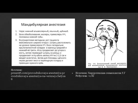 Источник: present5.com/provodnikovaya-anesteziya-provodnikovaya-anesteziya-na-verxnej-chelyusti Источник: Хирургическая стоматология.Т.Г Робустова –с.82