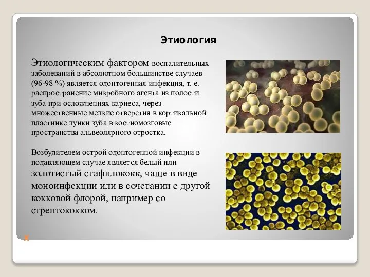 Х Этиология Этиологическим фактором воспалительных заболеваний в абсолютном большинстве случаев (96-98 %)