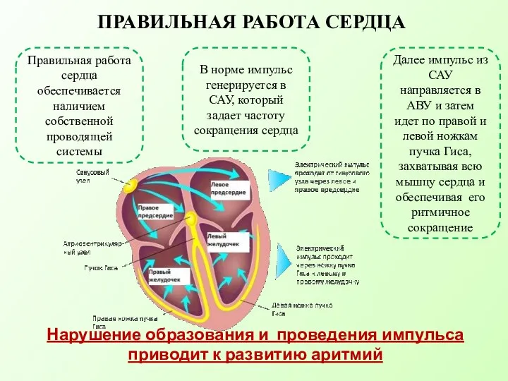 Нарушение образования и проведения импульса приводит к развитию аритмий ПРАВИЛЬНАЯ РАБОТА СЕРДЦА