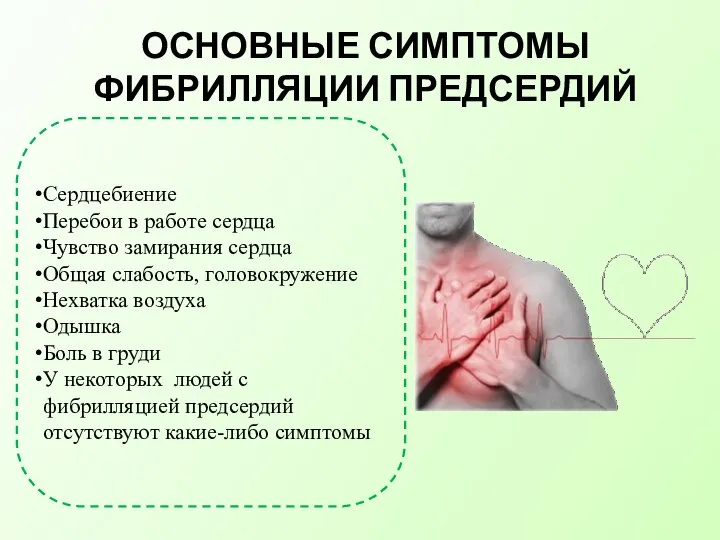 ОСНОВНЫЕ СИМПТОМЫ ФИБРИЛЛЯЦИИ ПРЕДСЕРДИЙ Сердцебиение Перебои в работе сердца Чувство замирания сердца