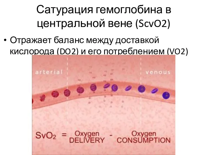 Отражает баланс между доставкой кислорода (DO2) и его потреблением (VO2) Сатурация гемоглобина в центральной вене (ScvO2)
