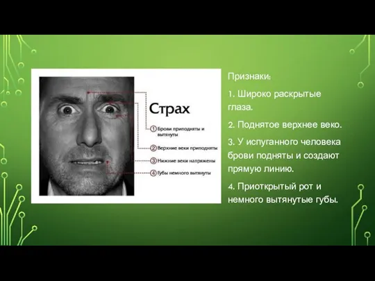 Признаки: 1. Широко раскрытые глаза. 2. Поднятое верхнее веко. 3. У испуганного