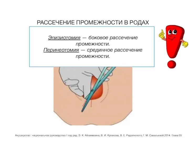 РАССЕЧЕНИЕ ПРОМЕЖНОСТИ В РОДАХ Эпизиотомия — боковое рассечение промежности. Перинеотомия — срединное