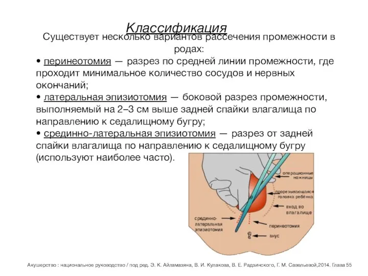 Классификация Существует несколько вариантов рассечения промежности в родах: • перинеотомия — разрез