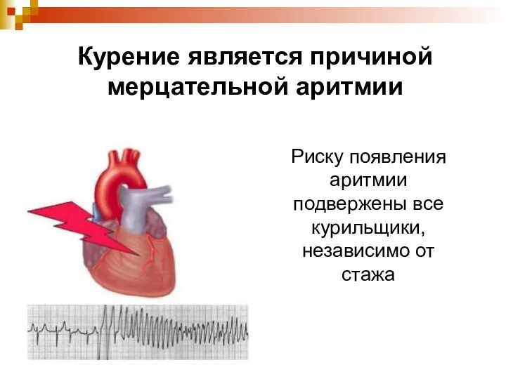 Риску появления аритмии подвержены все курильщики, независимо от стажа Курение является причиной мерцательной аритмии