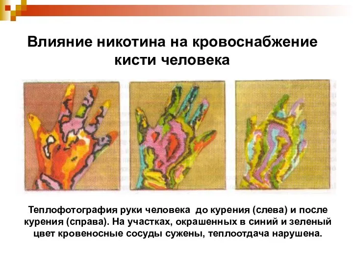 Влияние никотина на кровоснабжение кисти человека Теплофотография руки человека до курения (слева)