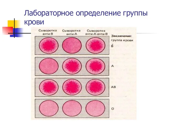 Лабораторное определение группы крови