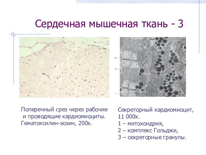 Сердечная мышечная ткань - 3 Поперечный срез через рабочие и проводящие кардиомиоциты.