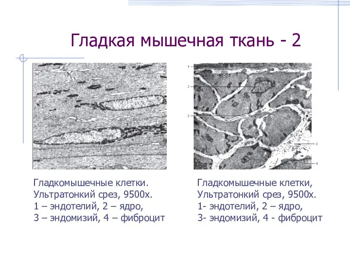 Гладкая мышечная ткань - 2 Гладкомышечные клетки, Ультратонкий срез, 9500х. 1- эндотелий,