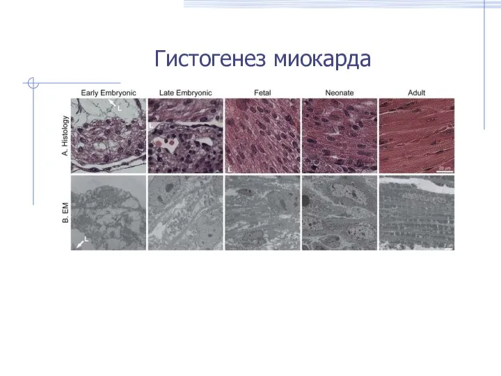 Гистогенез миокарда