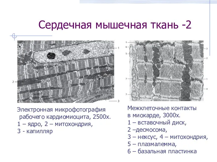 Сердечная мышечная ткань -2 Электронная микрофотография рабочего кардиомиоцита, 2500х. 1 – ядро,