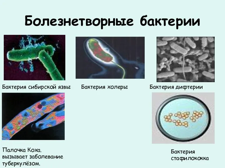 Болезнетворные бактерии Бактерия сибирской язвы Палочка Коха. вызывает заболевание туберкулёзом. Бактерия холеры Бактерия дифтерии Бактерия стафилококка