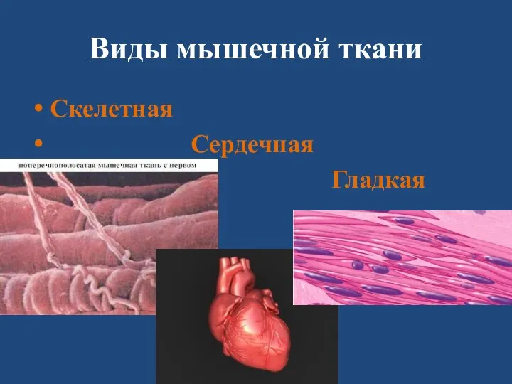 Виды мышечной ткани Скелетная Сердечная Гладкая