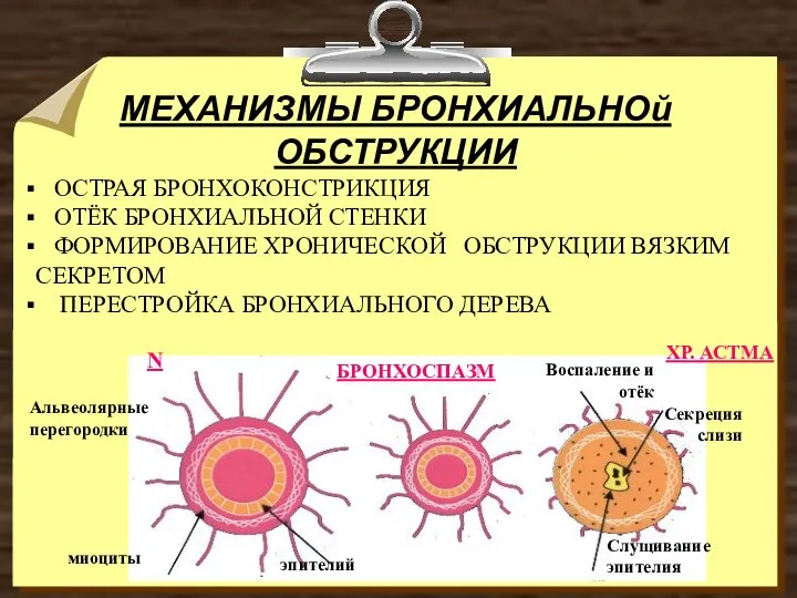 МЕХАНИЗМЫ БРОНХИАЛЬНОй ОБСТРУКЦИИ ОСТРАЯ БРОНХОКОНСТРИКЦИЯ ОТЁК БРОНХИАЛЬНОЙ СТЕНКИ ФОРМИРОВАНИЕ ХРОНИЧЕСКОЙ ОБСТРУКЦИИ ВЯЗКИМ