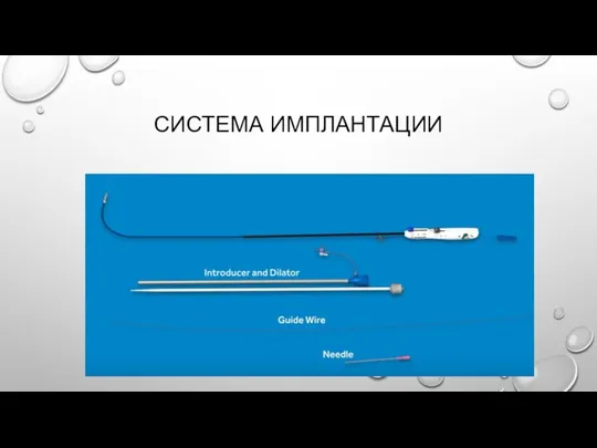 СИСТЕМА ИМПЛАНТАЦИИ